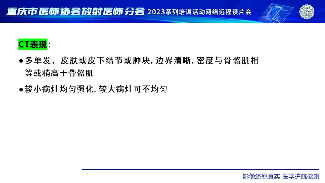 影像PPT - 【病例】腹壁隆突性皮肤纤维肉瘤1例MR影像-21