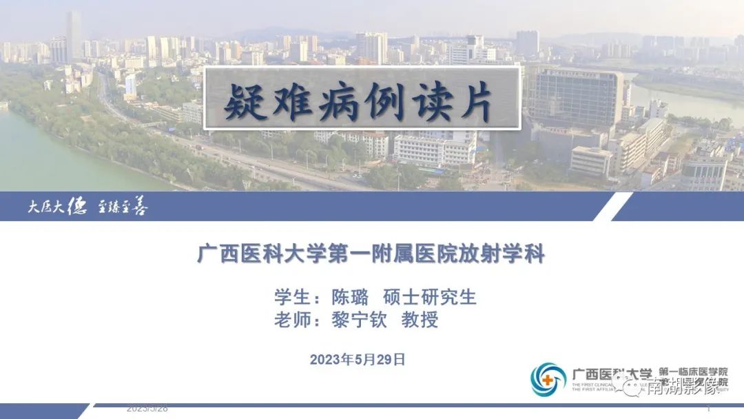 影像PPT - 【PPT】肾上腺节细胞神经瘤-1