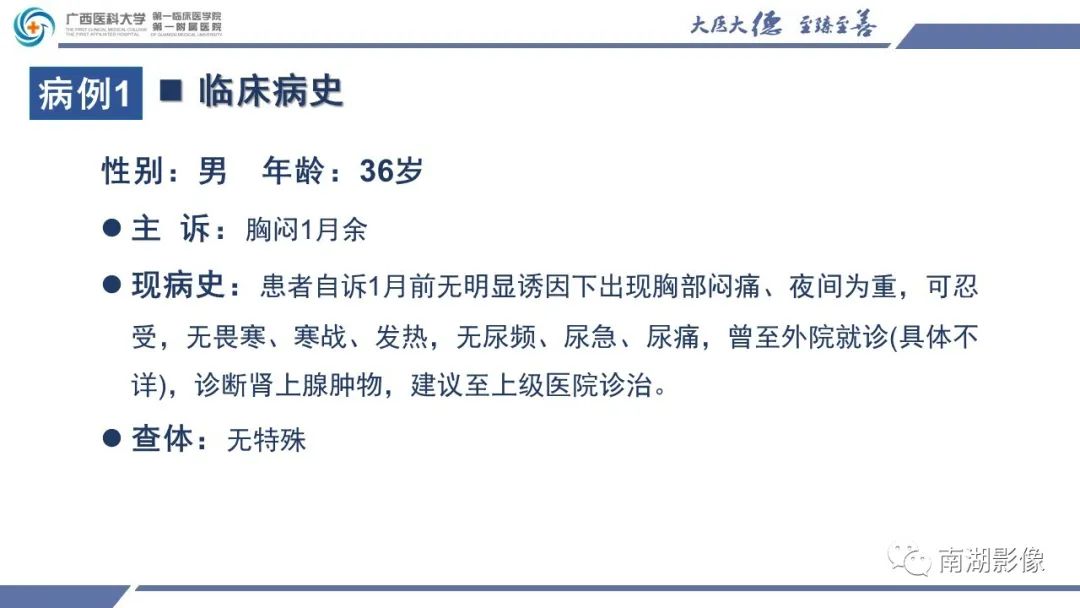 影像PPT - 【PPT】肾上腺节细胞神经瘤-2