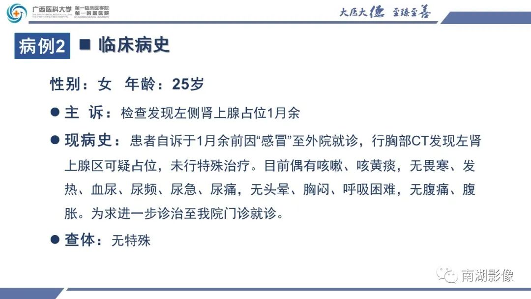 影像PPT - 【PPT】肾上腺节细胞神经瘤-7