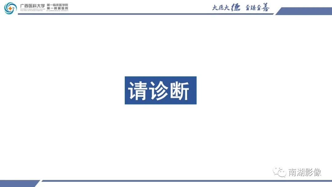 影像PPT - 【PPT】肾上腺节细胞神经瘤-12