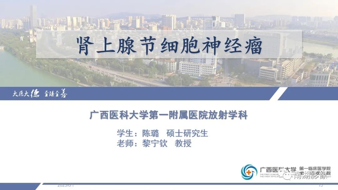 影像PPT - 【PPT】肾上腺节细胞神经瘤-15