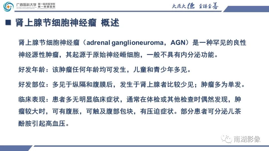 影像PPT - 【PPT】肾上腺节细胞神经瘤-17