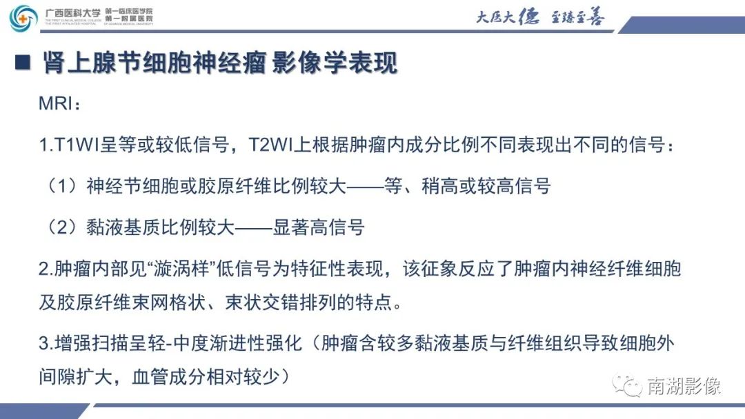 影像PPT - 【PPT】肾上腺节细胞神经瘤-20