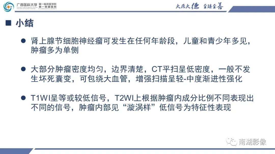 影像PPT - 【PPT】肾上腺节细胞神经瘤-27