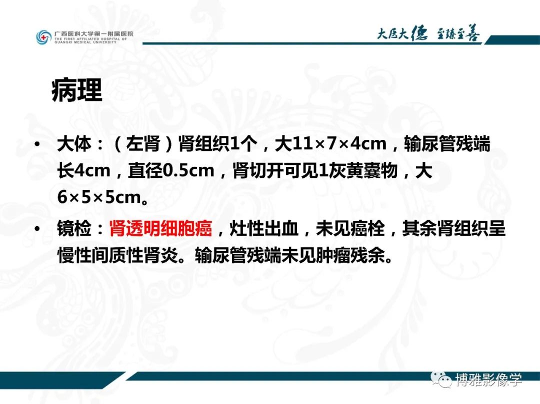 影像PPT - 【PPT】肾癌常见及少见征象的解读和鉴别诊断-4