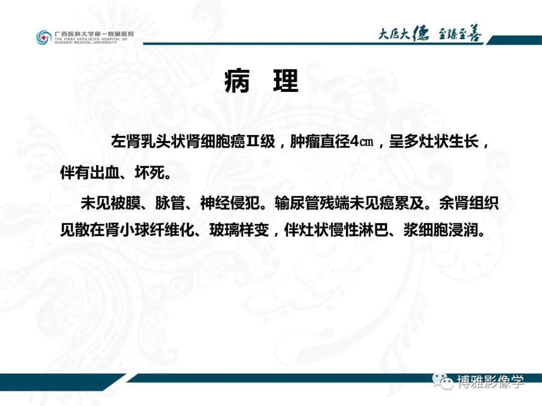 影像PPT - 【PPT】肾癌常见及少见征象的解读和鉴别诊断-6