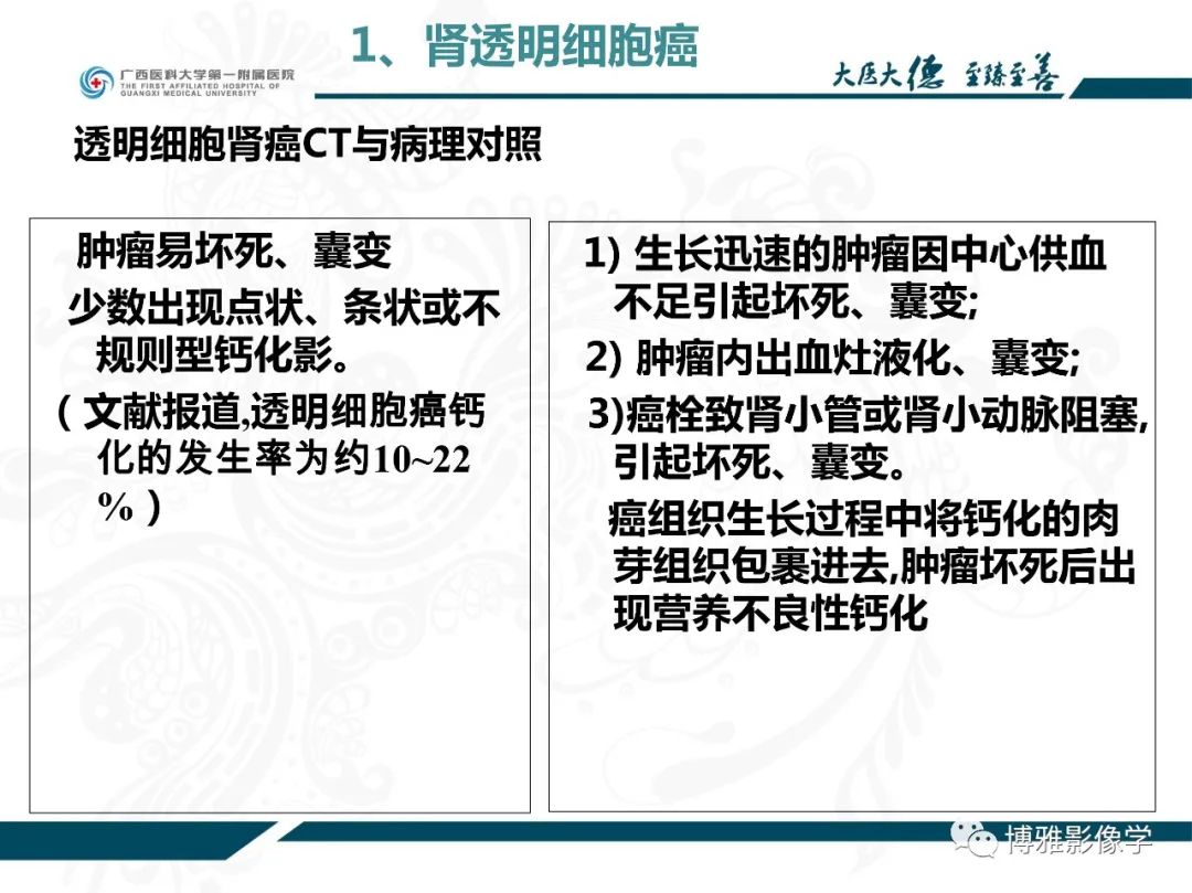 影像PPT - 【PPT】肾癌常见及少见征象的解读和鉴别诊断-16