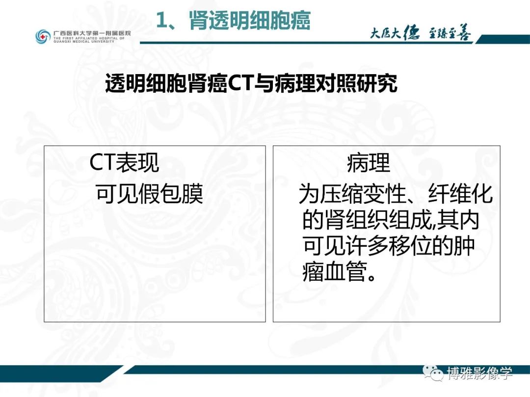 影像PPT - 【PPT】肾癌常见及少见征象的解读和鉴别诊断-18