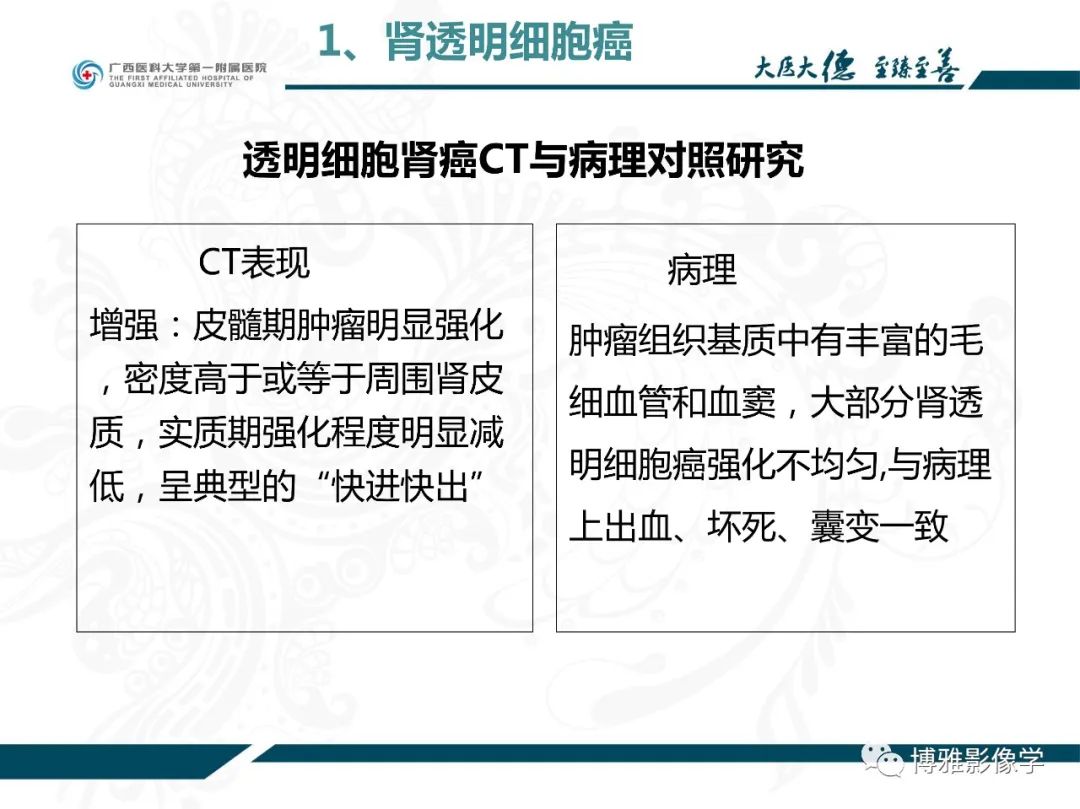 影像PPT - 【PPT】肾癌常见及少见征象的解读和鉴别诊断-19