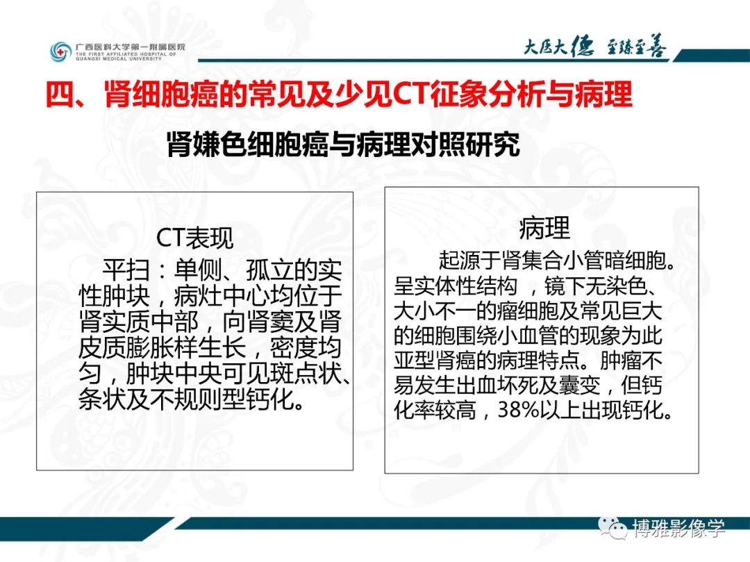 影像PPT - 【PPT】肾癌常见及少见征象的解读和鉴别诊断-36