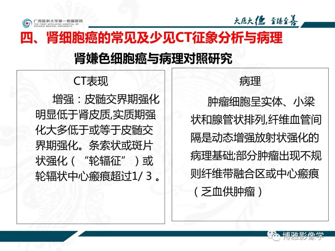 影像PPT - 【PPT】肾癌常见及少见征象的解读和鉴别诊断-37