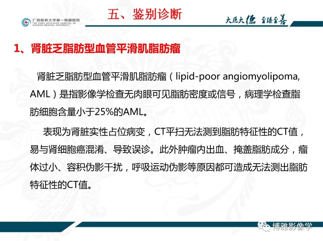 影像PPT - 【PPT】肾癌常见及少见征象的解读和鉴别诊断-51