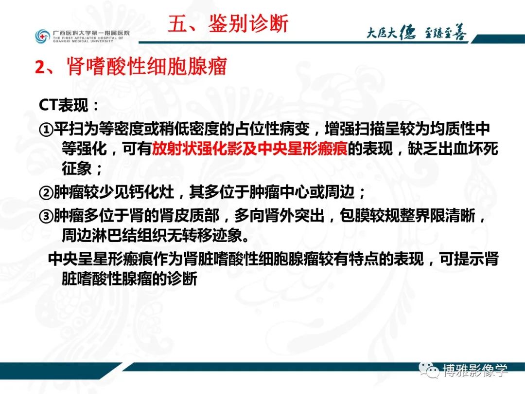 影像PPT - 【PPT】肾癌常见及少见征象的解读和鉴别诊断-61