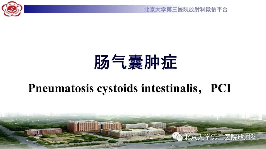 影像PPT - 【PPT】肠气囊肿症-10