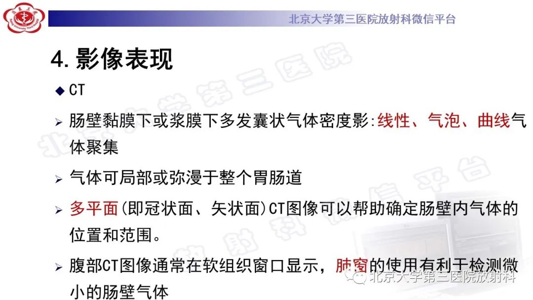 影像PPT - 【PPT】肠气囊肿症-19