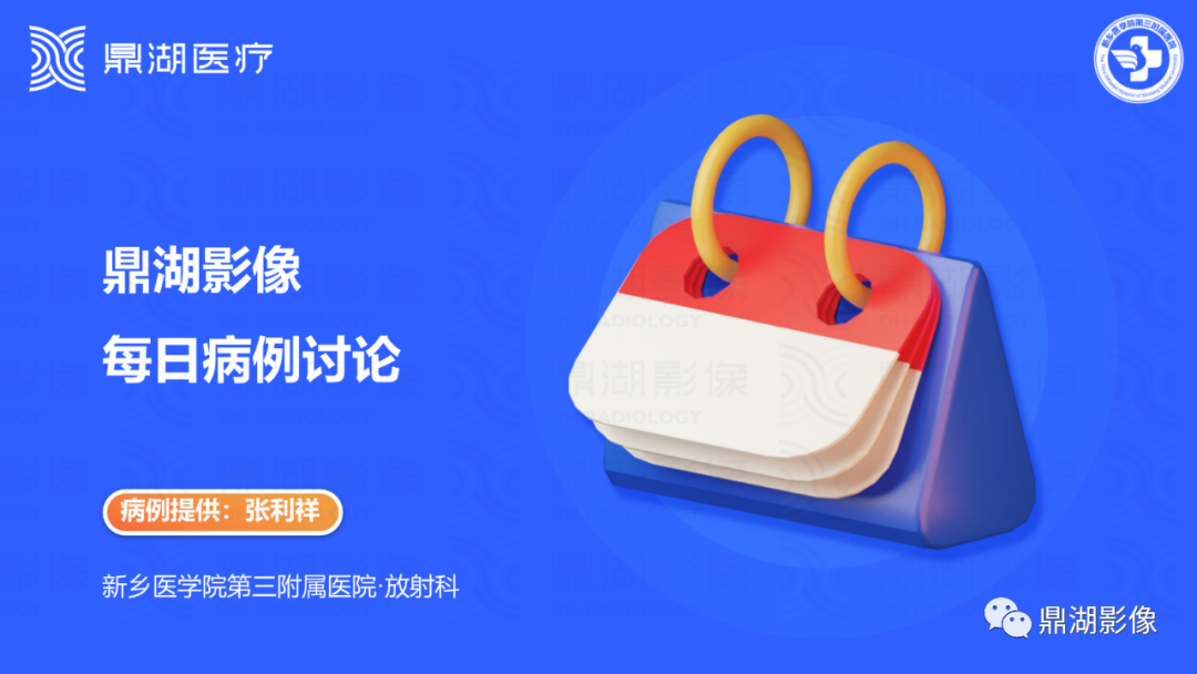 影像PPT - 【病例】肾脏血管平滑肌脂肪瘤—蛋筒冰淇淋征-1 影像PPT - 【病例】肾脏血管平滑肌脂肪瘤—蛋筒冰淇淋征-1