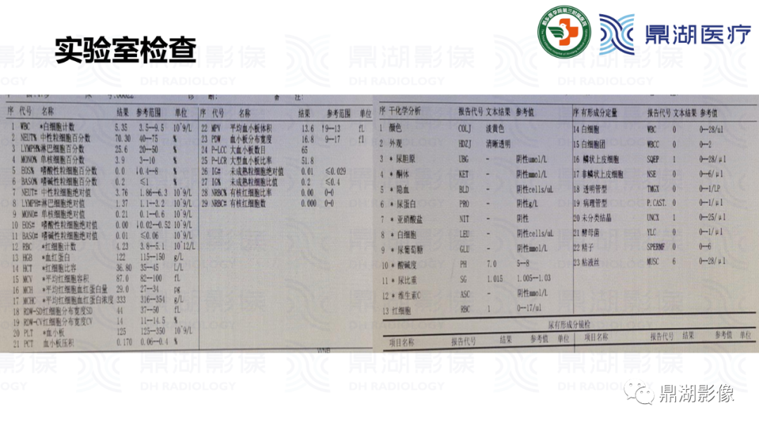 影像PPT - 【病例】肾脏血管平滑肌脂肪瘤—蛋筒冰淇淋征-5 影像PPT - 【病例】肾脏血管平滑肌脂肪瘤—蛋筒冰淇淋征-5
