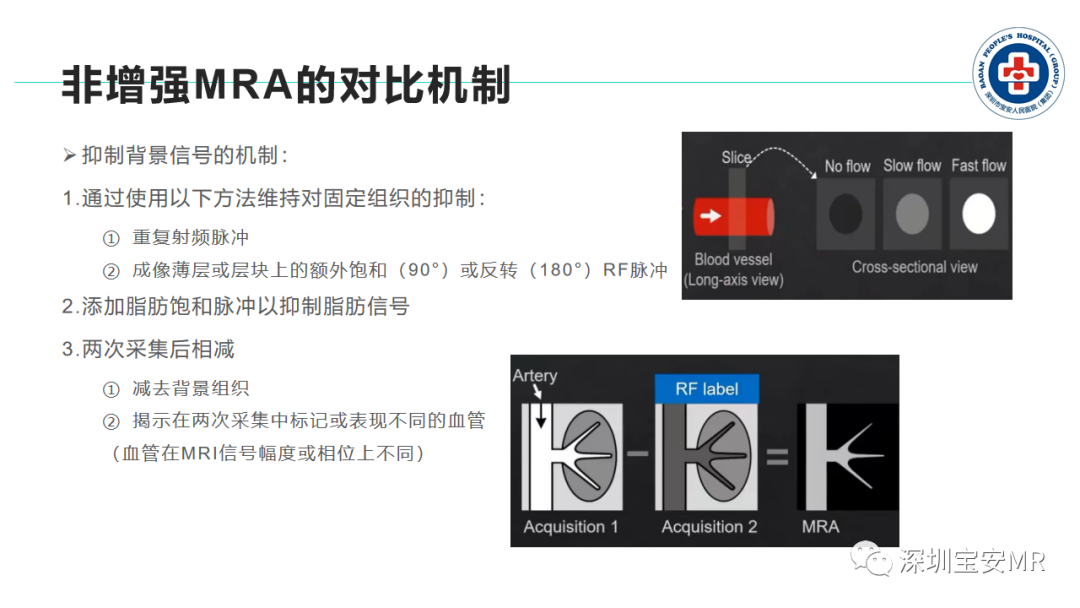 影像PPT - 【PPT】非增强MR血管成像技术-5