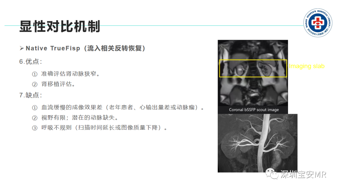 影像PPT - 【PPT】非增强MR血管成像技术-12