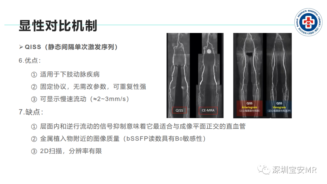 影像PPT - 【PPT】非增强MR血管成像技术-15