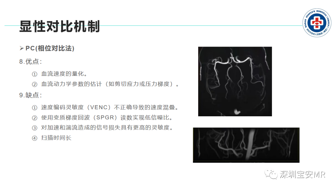 影像PPT - 【PPT】非增强MR血管成像技术-17