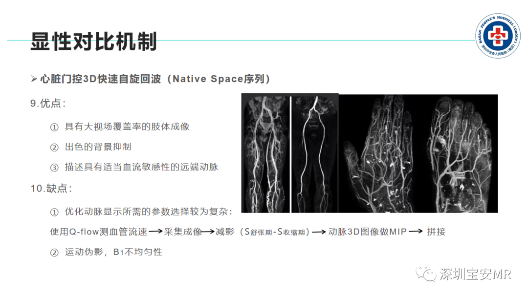 影像PPT - 【PPT】非增强MR血管成像技术-20