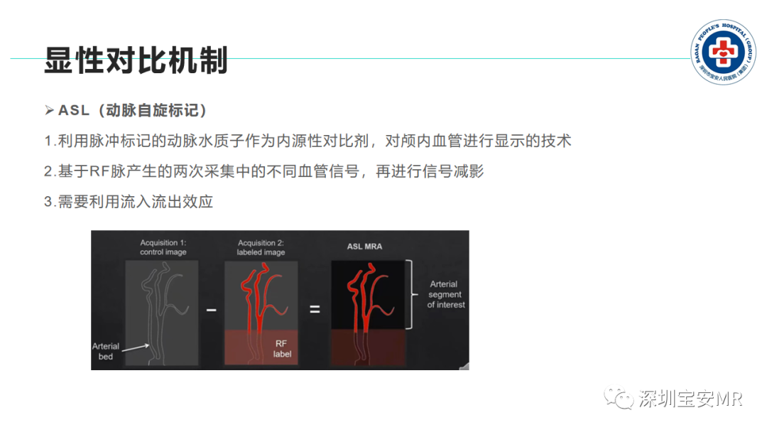 影像PPT - 【PPT】非增强MR血管成像技术-21