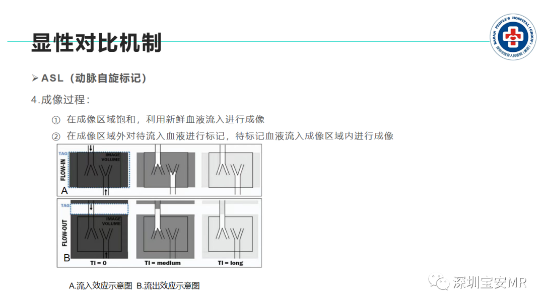 影像PPT - 【PPT】非增强MR血管成像技术-22