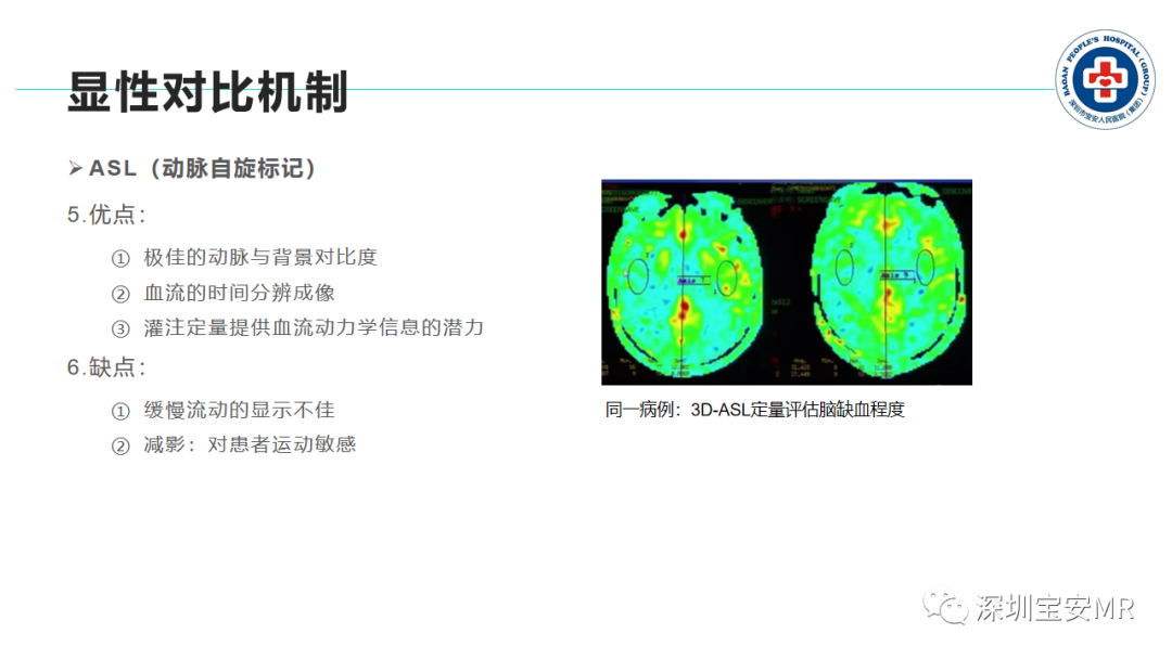 影像PPT - 【PPT】非增强MR血管成像技术-23