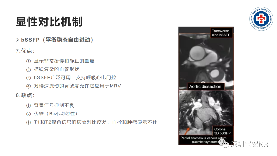 影像PPT - 【PPT】非增强MR血管成像技术-25