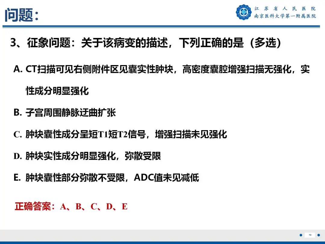 影像PPT - 【PPT】卵巢子宫内膜样癌-20