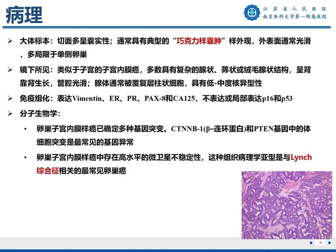 影像PPT - 【PPT】卵巢子宫内膜样癌-30