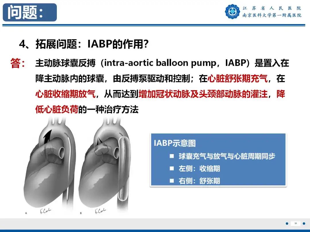 影像PPT - 【PPT】静脉动脉体外膜肺氧合CTA成像-32