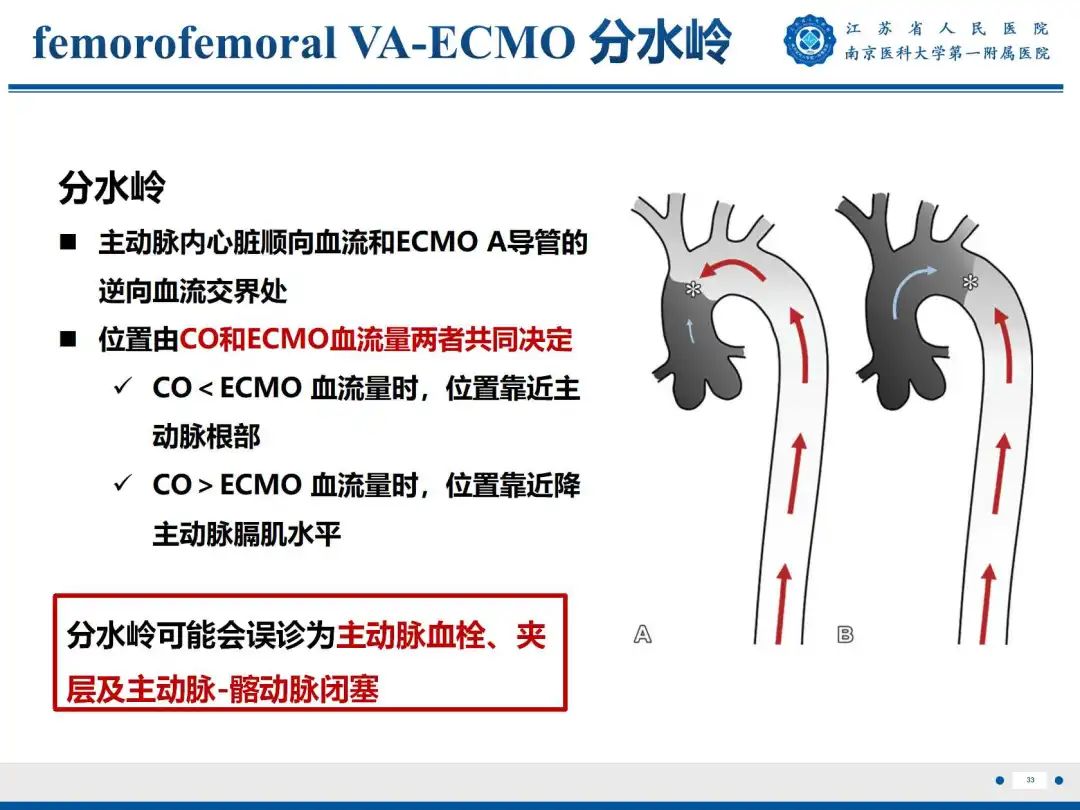 影像PPT - 【PPT】静脉动脉体外膜肺氧合CTA成像-34