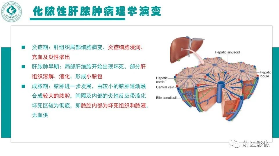 影像PPT - 【病例】细菌性肝脓肿 VS 胆管细胞癌-11