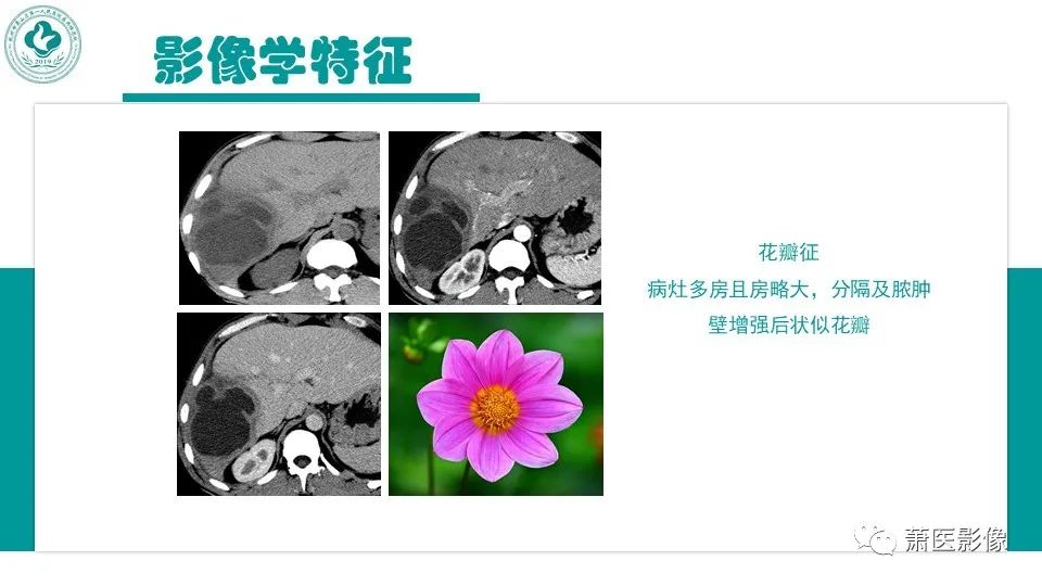 影像PPT - 【病例】细菌性肝脓肿 VS 胆管细胞癌-16