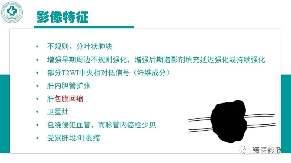 影像PPT - 【病例】细菌性肝脓肿 VS 胆管细胞癌-25