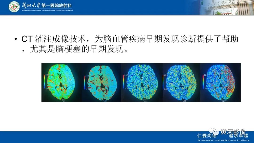 影像PPT - 【PPT】缺血性脑血管病CT灌注扫描-5