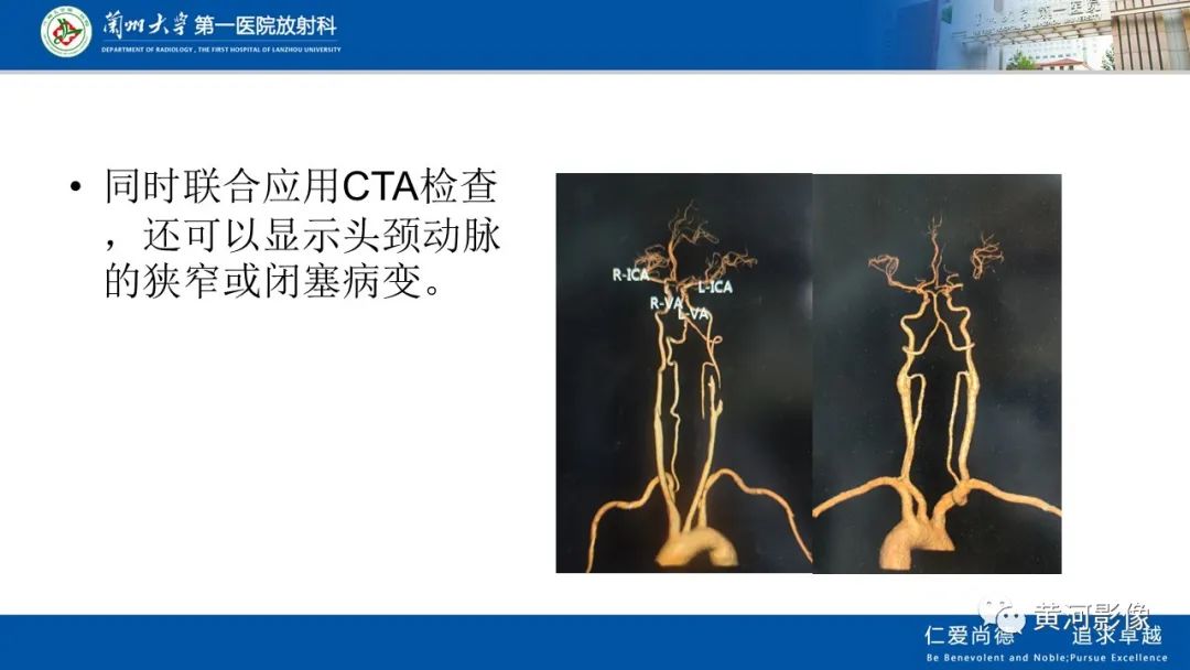 影像PPT - 【PPT】缺血性脑血管病CT灌注扫描-7