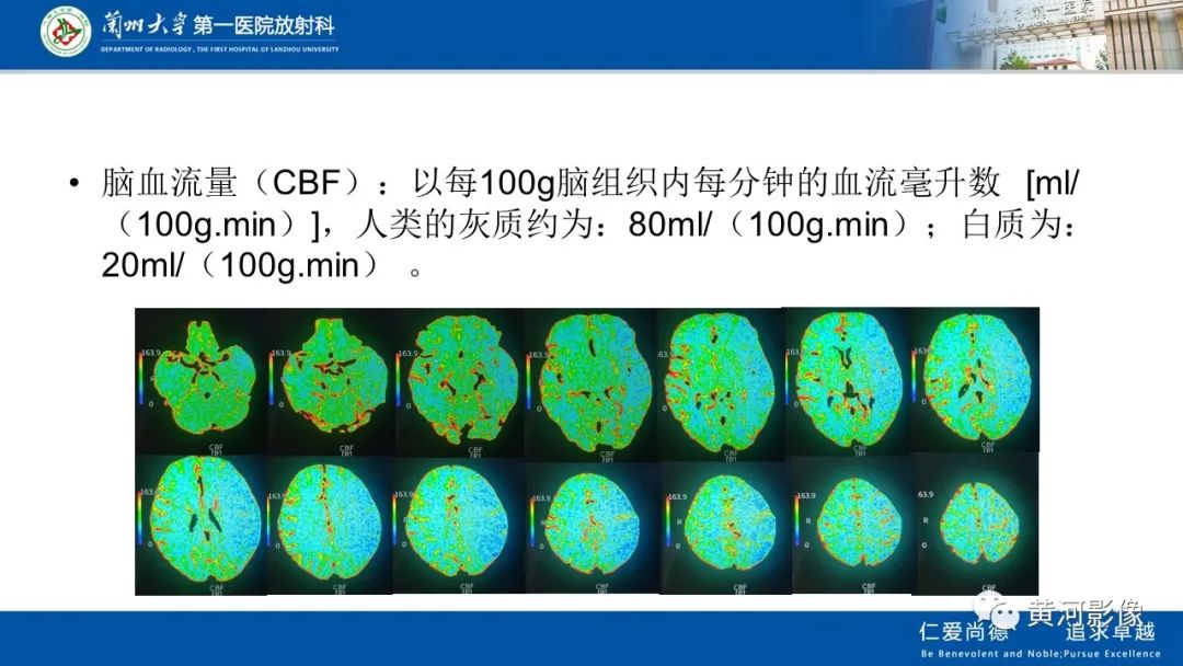 影像PPT - 【PPT】缺血性脑血管病CT灌注扫描-17
