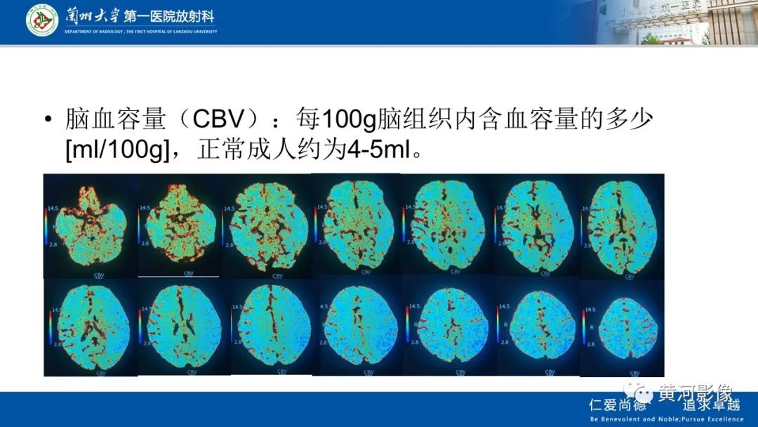 影像PPT - 【PPT】缺血性脑血管病CT灌注扫描-18