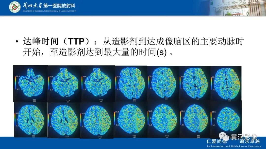 影像PPT - 【PPT】缺血性脑血管病CT灌注扫描-19