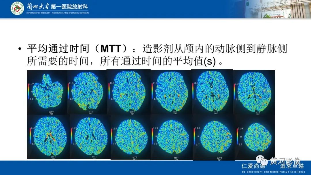 影像PPT - 【PPT】缺血性脑血管病CT灌注扫描-20