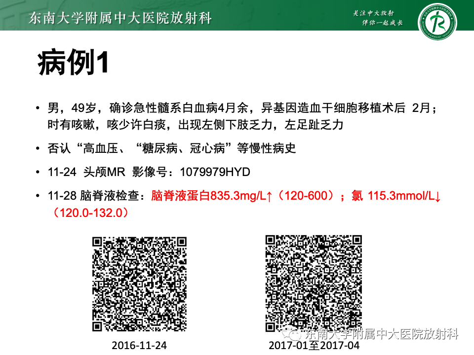 影像PPT - 【PPT】成人常见脑白质病变影像诊断-1