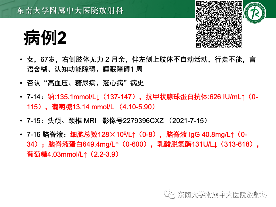 影像PPT - 【PPT】成人常见脑白质病变影像诊断-5