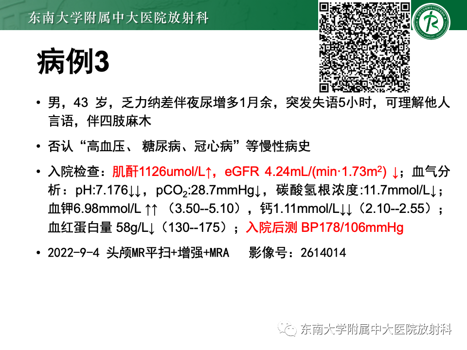 影像PPT - 【PPT】成人常见脑白质病变影像诊断-11