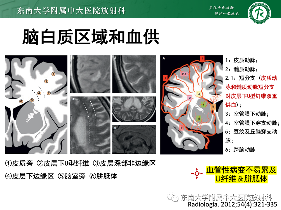 影像PPT - 【PPT】成人常见脑白质病变影像诊断-20