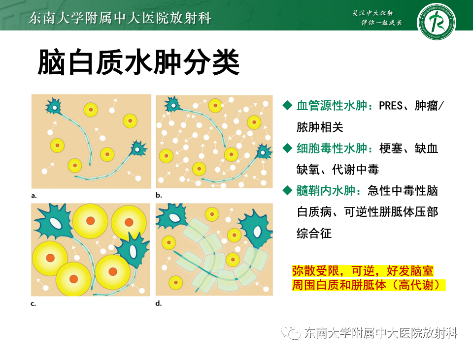 影像PPT - 【PPT】成人常见脑白质病变影像诊断-23
