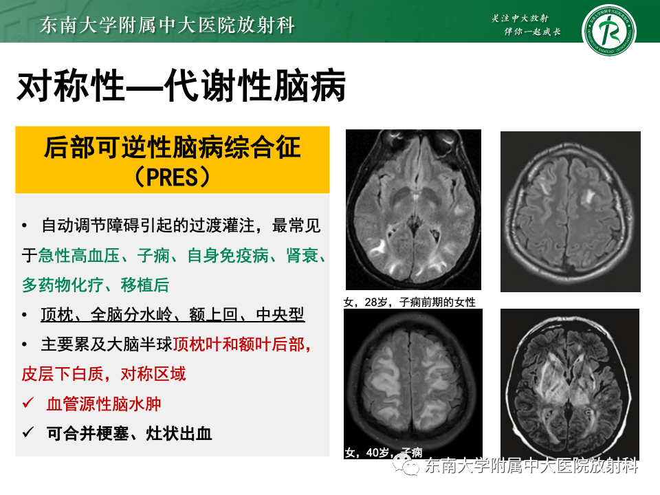 影像PPT - 【PPT】成人常见脑白质病变影像诊断-24